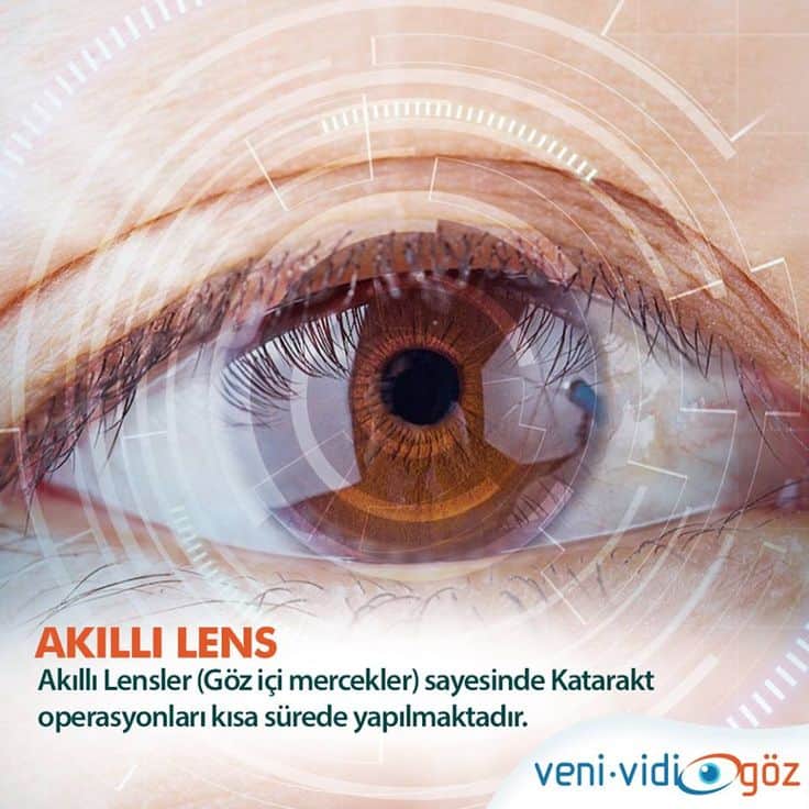 Akın Akyurt Akıllı Lensler