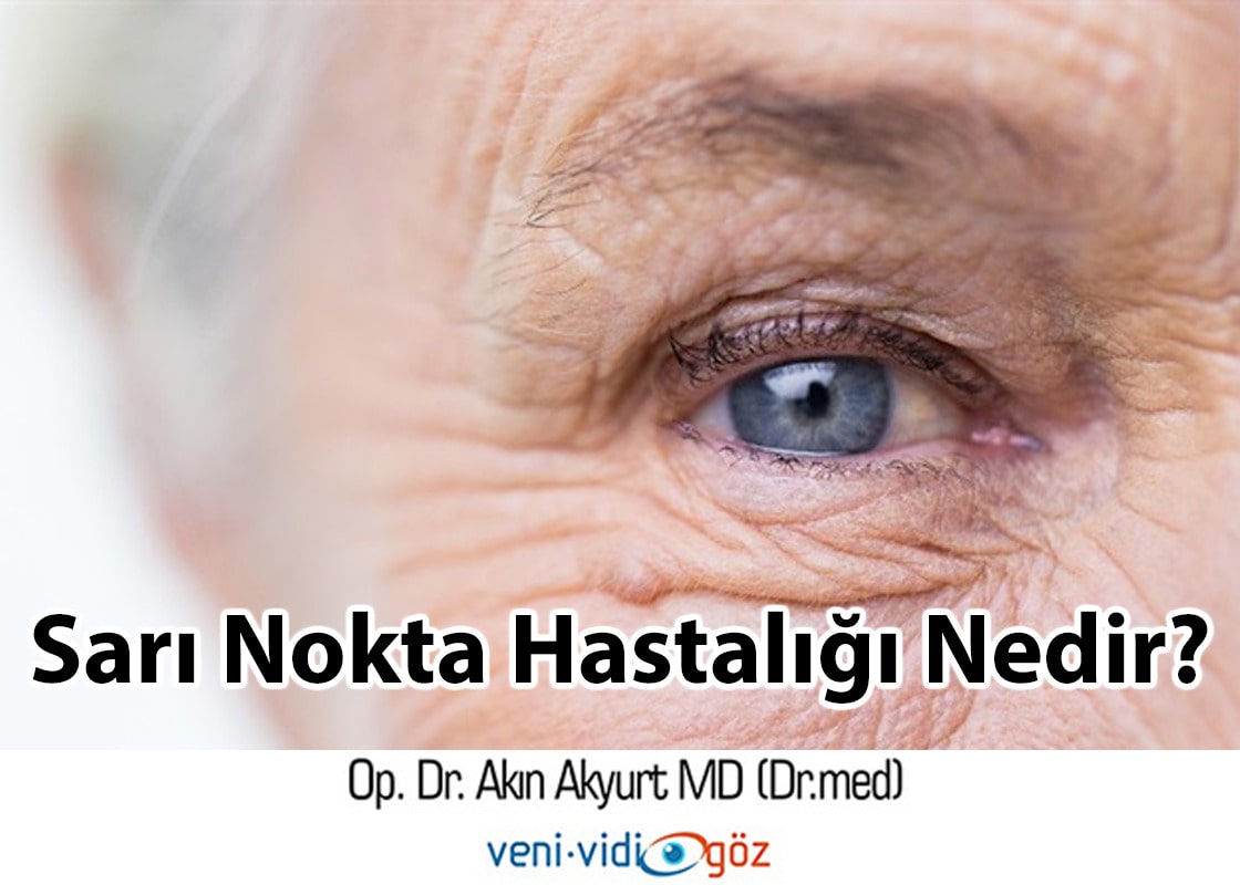 Sarı Nokta Hastalığı Nedir